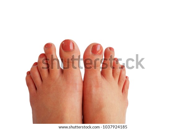 Asian Toes