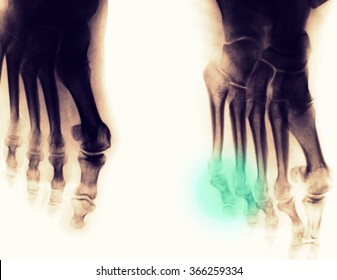 Foot Xray (X-ray) Photo