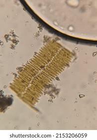 Footage Of Ladder Like Diatoms Algae Moving Under The Microscope