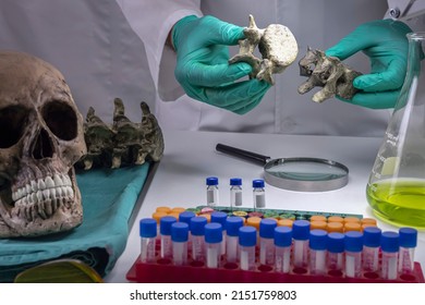 Forensic scientist comparing two human vertebrae of adult male homicide victims to extract DNA, forensic lab, conceptual image