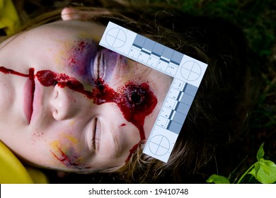 Forensically Accurate Photo Of A Teen With A Bullet Wound