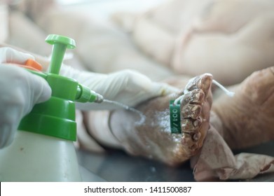 Formalin is used during embalming processes as a disinfectant and preservative of the human body. - Shutterstock ID 1411500887