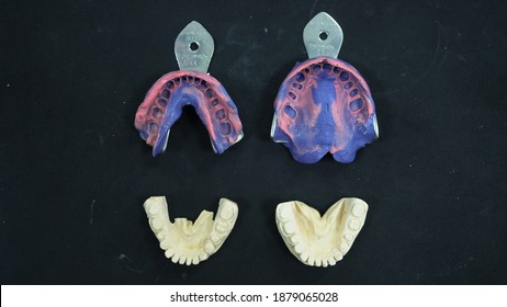 four dental impressions dental guides for large implantation the upper   lower jaws  top view black background