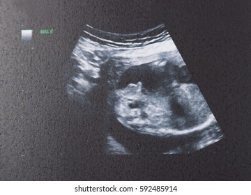 30 weeks pregnant ultrasound boy