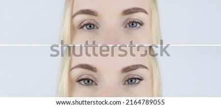 Fox eye lift. Before and after. On left is a girl with normal eyes, and on right is after an imitation operation eyes look foxy. Concept of changing the appearance with threads or botulinum toxin.