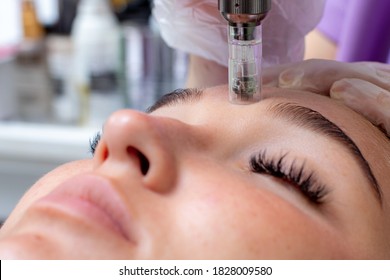 Fractional microneedle facial therapy close up
