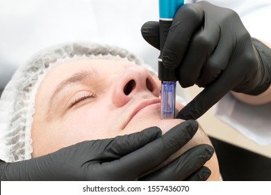 Fractional microneedle lifting procedure for men in a beauty salon