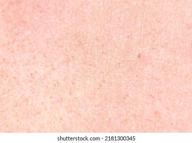 Freckles On The Skin Of The Back As A Background.