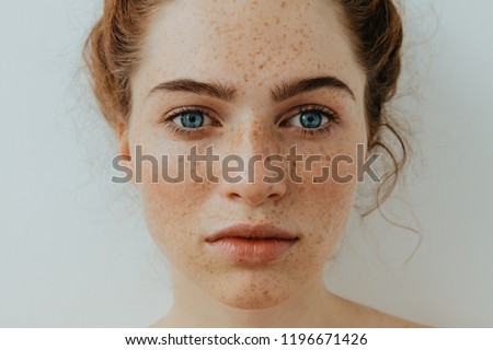 Freckles Woman portrait. Close-up. Beautiful blue eyed girl with freckles is looking at camera, on a white background