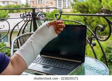 Freelancer With One Broken Wrist Typing On Laptop Computer On Keyboard At Home On Glass Table. Close-up. Woman Hand In White Plaster Cast Is Working On A Computer. 