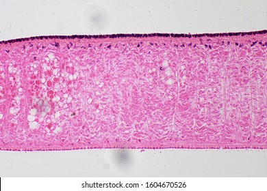 Free-living Flatworm (Turbellaria) Under The Microscope