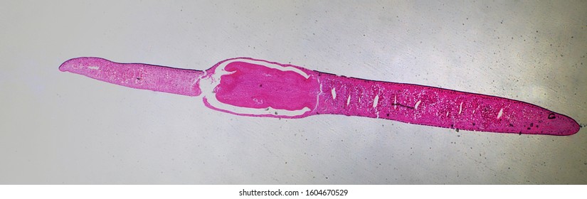 Free-living Flatworm (Turbellaria) Under The Microscope