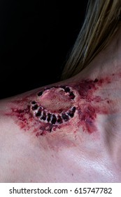 Fresh Bloody Bite From A Zombie Or Monster On A Shoulder Of Blonde Woman. Scarry Scene.