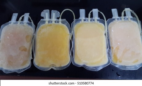 Fresh Frozen Plasma