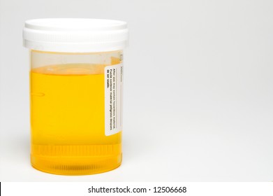 Fresh Urine Sample