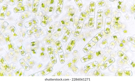 Freshwater algae blooming under microscope. The species probably Cylindrocystis sp. Selective focus image
