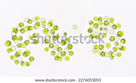 Freshwater colonial green microalgae, probably Dictyosphaerium sp. Live cells. 400x magnification. Selective focus