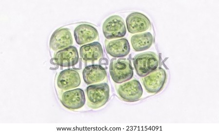 Freshwater cyanobacteria, Chroococcus sp. Stacked photo