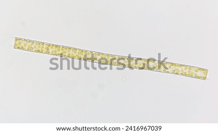 A freshwater diatom called Aulacoseira sp. 400x objective. Selective focus