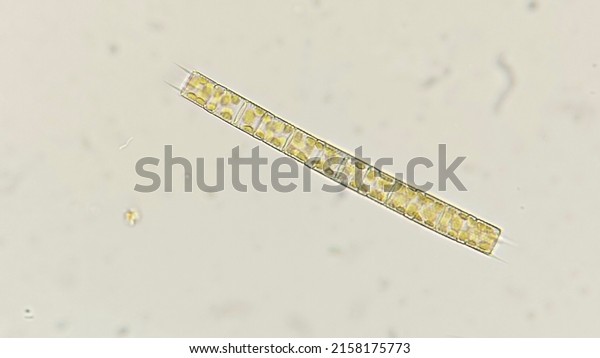 A freshwater diatom called\
Aulacoseira sp. 400x microscope magnification + 4x camera\
zoom