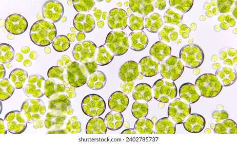 Freshwater microalgae blooming under microscope. The species is probably Chlamydocapsa sp. 800x magnification. Live cell. Selective focus