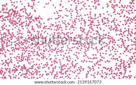 Frog blood, light microscopy. Unlike mammalian erythrocytes (red blood cells) mature frog erythrocytes retain their nuclei. Magnification: x100. 