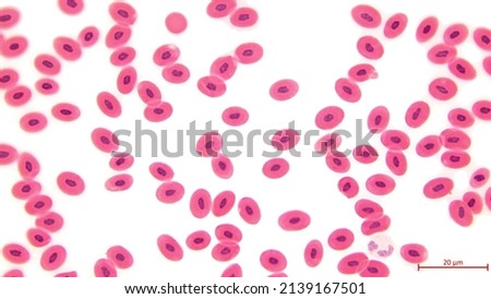 Frog blood, light microscopy. Unlike mammalian erythrocytes (red blood cells) mature frog erythrocytes retain their nuclei. Magnification: x400. 