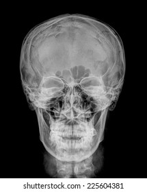 11,703 Face X Ray Images, Stock Photos & Vectors | Shutterstock