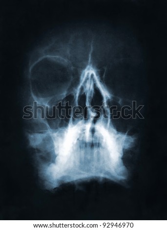 Front face skull x-ray image