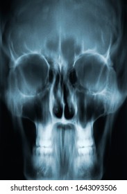 Front View Of A Human Adult Male Skull X-ray Image Or Radiography. Medical Imagery.