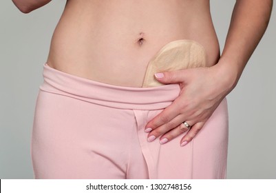 front view on colostomy pouch attached to woman patient hidden in pants close-up, medical theme - image