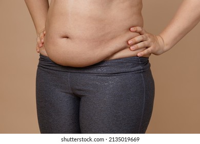 Front View Of Overweighted Thick Belly Of Woman Wearing Leggings. Body Positive. Violation Of Cell Elasticity, Loss Of Nutrients. Sagging Skin After Pregnancy Or Sudden Weight Loss.