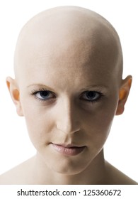 Frontal Portrait Of A Young Bald Woman