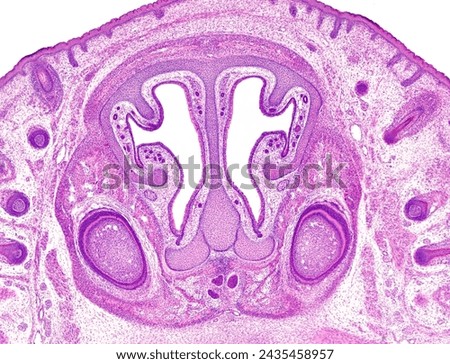 Frontal section of a rat embryo head showing the nasal cavities with turbinates, nasal septum and olfactory epithelium. Two teeth germs (cap stage) can be seen in the developing maxilla.