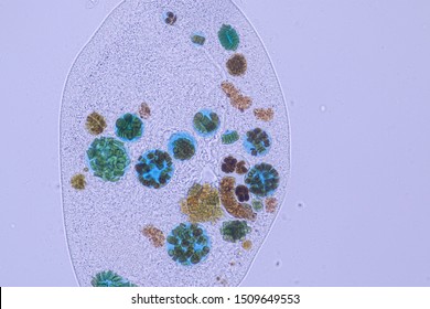 Frontonia Sp. Is A Genus Of Free-living Unicellular Ciliate Protists Under The Microscope.
