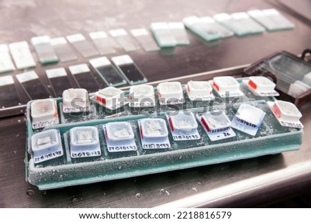 Frozen blocks of paraffin embedded tissue kept cold on ice ready to be cut using a microtome. Paraffin blocks containing biopsy tissue for sectioning. Pathology laboratory. Cancer diagnosis.