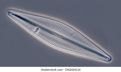 multiple diatoms labeled