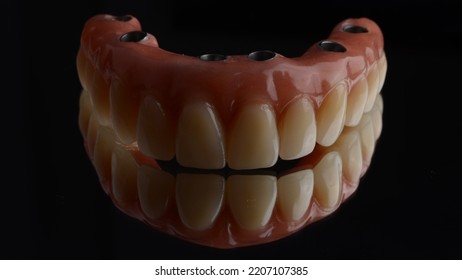 Full Arch Fixed Dental Prostheses On Dental Implant With Black Background.