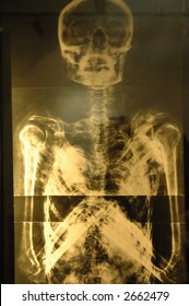 577 Full body xrays Images, Stock Photos & Vectors | Shutterstock