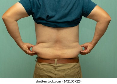 Full Man Holds His Hand Folds Of Fat On Their Sides, View From Behind