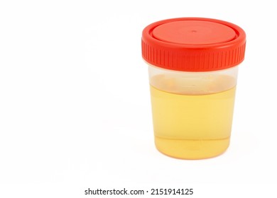 Full plastic jar with urine for medical tests isolated on white background. Urine sample in container. Drug, alcohol or disease tests