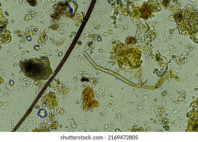 Fungal and fungi hyphae under the microscope in the soil and compost, in a soil biology and microorganism test in Australia.