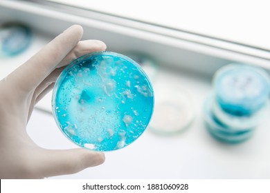 Fungal Mycelium Petri Dish. Mycology Growing In A Petri Dishes. Laboratory Accessories.