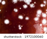 Fungal spores in the liquid. Viral bacteriumi n the blood.Fungal infection.distribution and multiplication of fungi and bacteria.