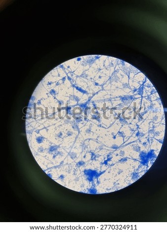 Fungal Structures under Microscope Hyphae acremonium