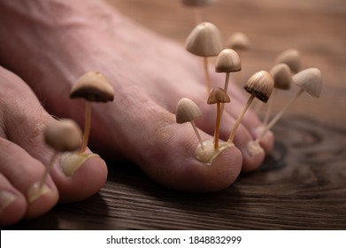 Fungi grow from the nail plates on the feet. Concept of nail fungus, skin and nail infections. Two legs with a fungus close-up in the background light.