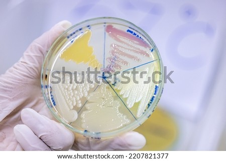 The fungus and bacteria is used for composting, Used for agriculture.