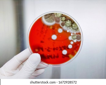 Fungus Growth On Blood Agar Medium From Sputum Culture, Soft Focus