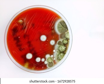 Fungus Growth On Blood Agar Medium From Sputum Culture, Soft Focus