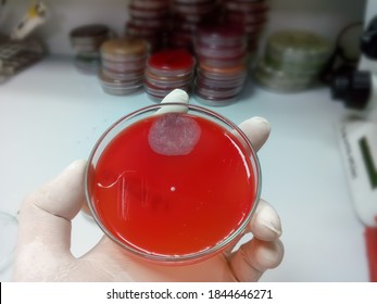 Fungus Growth On Blood Agar Medium, Sputum Culture